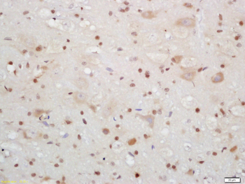 CIRBP Rabbit Polyclonal Antibody