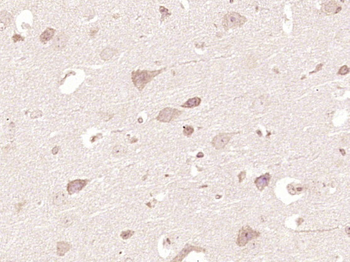 BMPER Rabbit Polyclonal Antibody