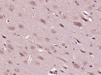 BMPER Rabbit Polyclonal Antibody