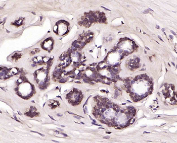 DUSP26 Rabbit Polyclonal Antibody