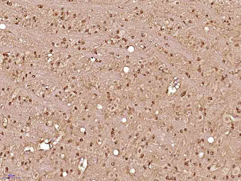 DUSP26 Rabbit Polyclonal Antibody