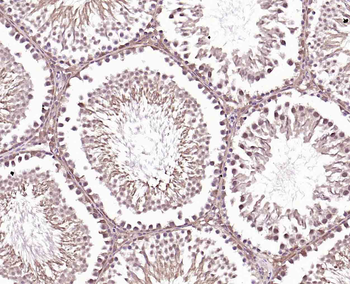 DUSP26 Rabbit Polyclonal Antibody