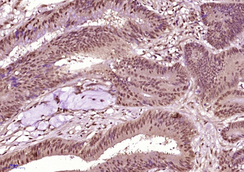 Phospho-NF1 (Ser2515) Rabbit Polyclonal Antibody