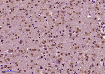 Phospho-NF1 (Ser2515) Rabbit Polyclonal Antibody