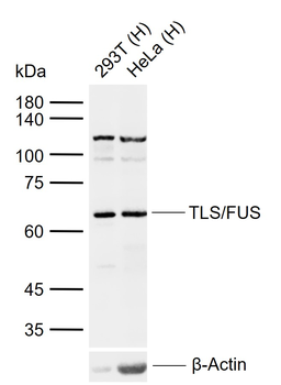 TLS/FUS Rabbit Polyclonal Antibody