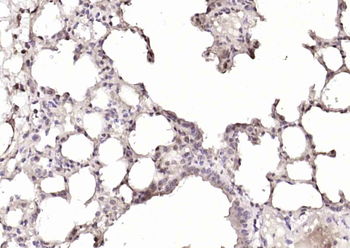 USP28 Rabbit Polyclonal Antibody