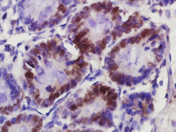 KLK6 Rabbit Polyclonal Antibody