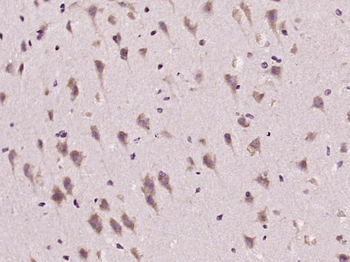 ADORA2B Rabbit Polyclonal Antibody