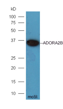 ADORA2B Rabbit Polyclonal Antibody