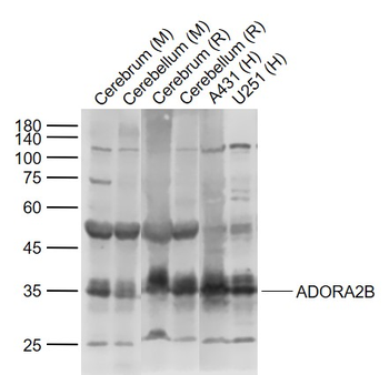 ADORA2B Rabbit Polyclonal Antibody