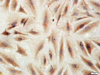 ADORA2B Rabbit Polyclonal Antibody