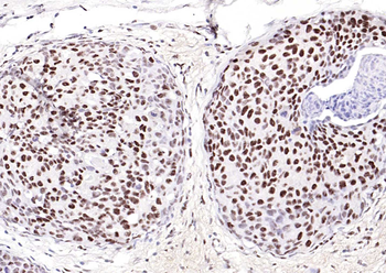 MYBL2 Rabbit Polyclonal Antibody