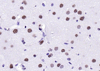 MYBL2 Rabbit Polyclonal Antibody