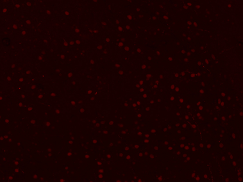 MYBL2 Rabbit Polyclonal Antibody