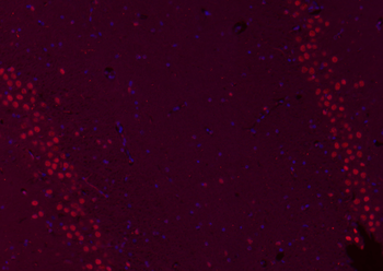 MYBL2 Rabbit Polyclonal Antibody