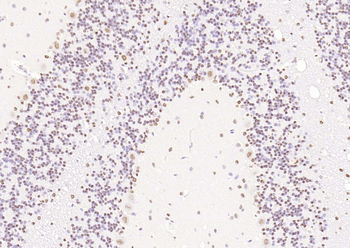 MYBL2 Rabbit Polyclonal Antibody