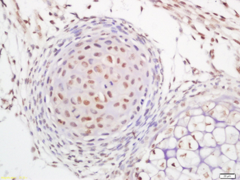 MYBL2 Rabbit Polyclonal Antibody