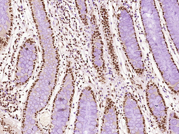 MYBL2 Rabbit Polyclonal Antibody