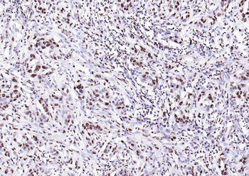 MYBL2 Rabbit Polyclonal Antibody