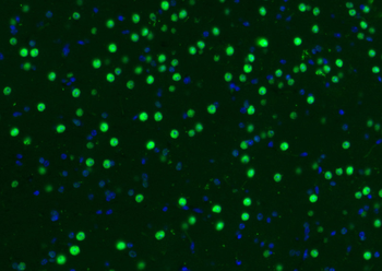 MYBL2 Rabbit Polyclonal Antibody