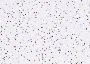 MYBL2 Rabbit Polyclonal Antibody