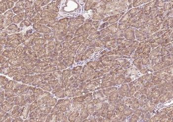 Frizzled 5 Rabbit Polyclonal Antibody