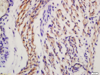 Frizzled 5 Rabbit Polyclonal Antibody