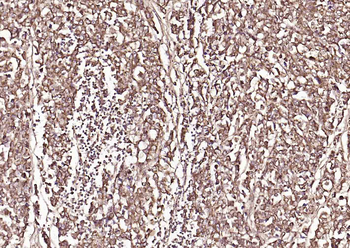 Frizzled 5 Rabbit Polyclonal Antibody