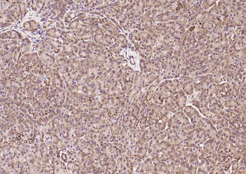 Frizzled 5 Rabbit Polyclonal Antibody