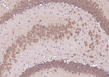 Frizzled 5 Rabbit Polyclonal Antibody