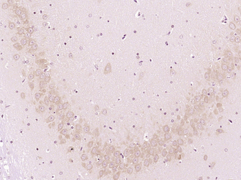Protective protein/Cathepsin A Rabbit Polyclonal Antibody