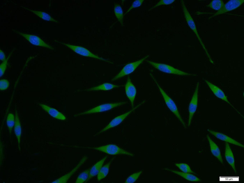 NARC1/PCSK9 Rabbit Polyclonal Antibody