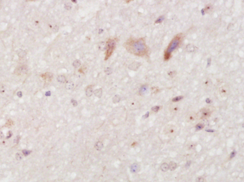 NARC1/PCSK9 Rabbit Polyclonal Antibody
