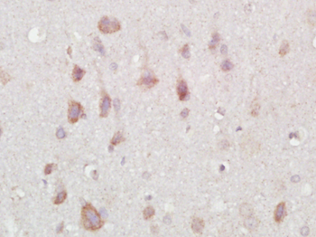 NARC1/PCSK9 Rabbit Polyclonal Antibody