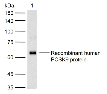 NARC1/PCSK9 Rabbit Polyclonal Antibody