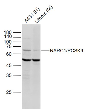NARC1/PCSK9 Rabbit Polyclonal Antibody