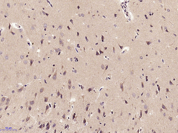 SPARCL1 Rabbit Polyclonal Antibody