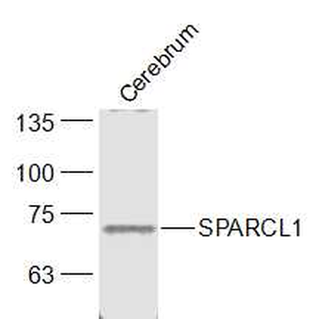 SPARCL1 Rabbit Polyclonal Antibody