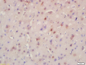 BRD8 Rabbit Polyclonal Antibody