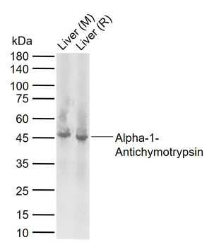 AACT Rabbit Polyclonal Antibody