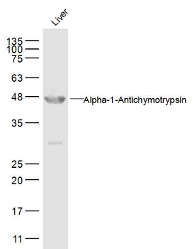 AACT Rabbit Polyclonal Antibody