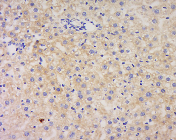 AACT Rabbit Polyclonal Antibody