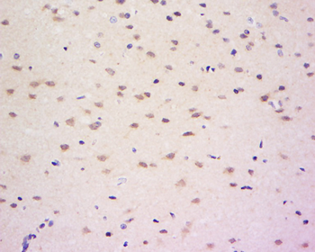 AACT Rabbit Polyclonal Antibody