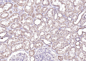Phospho-ROCK1 (Thr455+Ser456) Rabbit Polyclonal Antibody