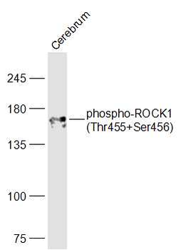 Phospho-ROCK1 (Thr455+Ser456) Rabbit Polyclonal Antibody