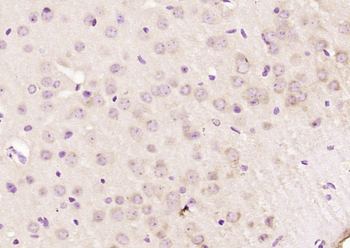 Phospho-MARK4 (Ser423) Rabbit Polyclonal Antibody