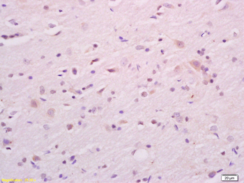 CKAP4 Rabbit Polyclonal Antibody