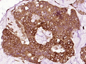 Vinculin Rabbit Polyclonal Antibody