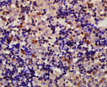 Vinculin Rabbit Polyclonal Antibody