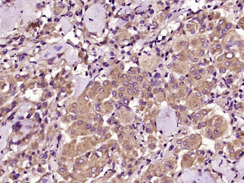 IGF2R/M6PR Rabbit Polyclonal Antibody